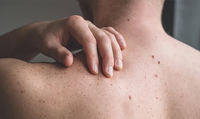 Medical Dermatology photo