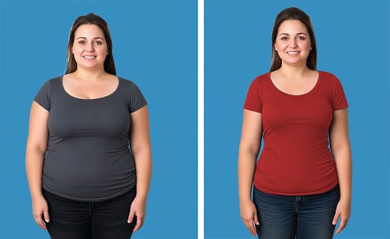 http://Female%20body,%20before%20and%20after%20Weight%20Loss%20Treatment,%20set%201,%20patient%204 photo