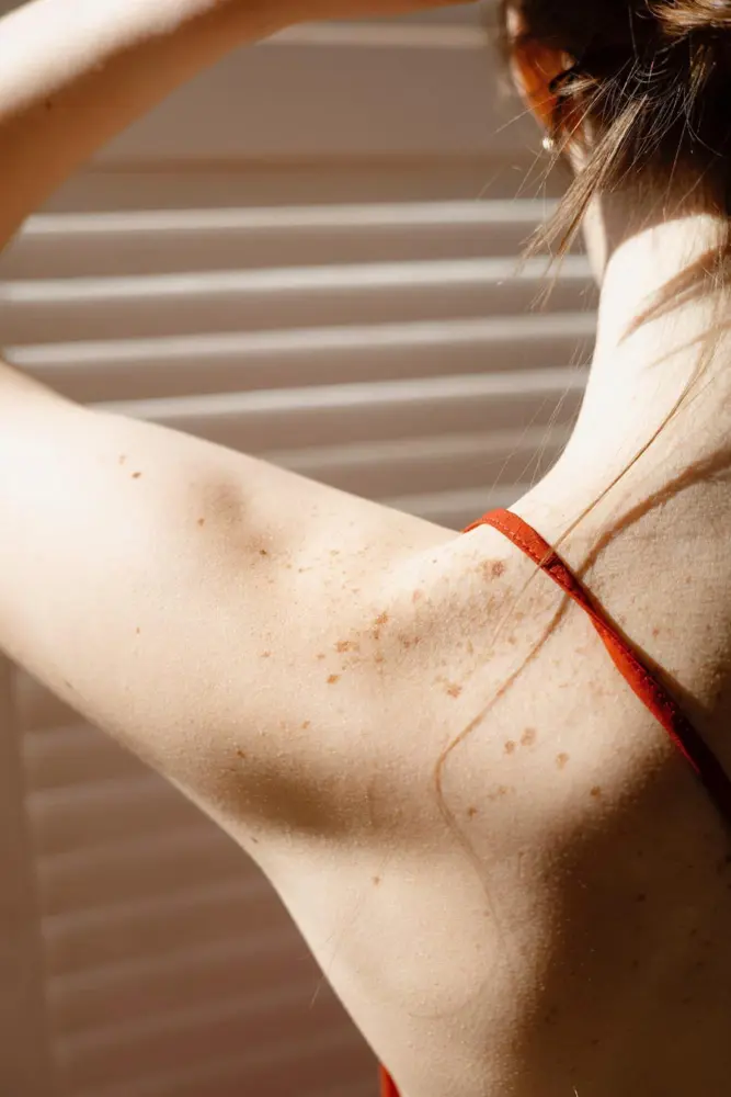 Mohs Surgery in Venice, FL at Rejuva Dermatology & Vein Center